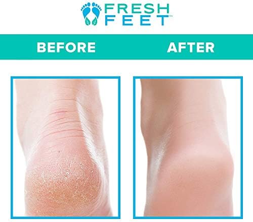 Fresh Feet- Foot Scrubber With Pumice Stone, Cleans, Smooths, Exfoliates & Massages your Feet Without Bending in the Shower or Bathtub