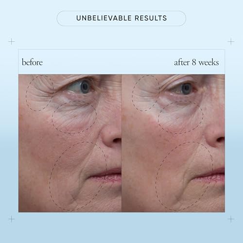 philosophy when hope is not enough facial firming serum - with vitamins C, E & hyaluronic acid - revitalizes dull complexion while reducing the look of fine lines and wrinkles - 1 fl oz