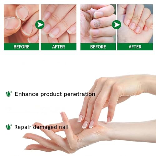 7 days Nail Growth Serum, 2PCS 7 Days Ginger Nail Essence, Multi-Purpose Nail Repair, Nail Nutrient Oil Strengthener Oil (2pcs)