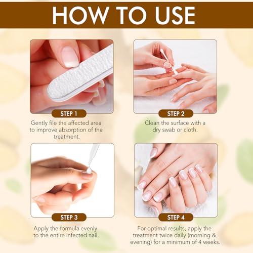 Ginger Nail Treatment, Nail Growth Serum, Nail Repair & Strengthening Oil, Ginger Cuticle Care Oil, Deep Hydration & Nourishing Support for Healthy Nails, 30ml, 2PCS