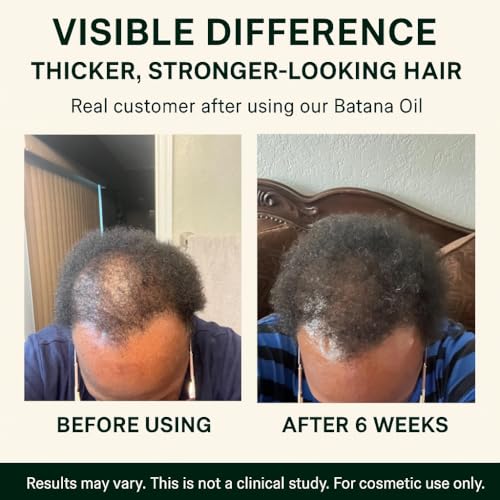 Unrefined Batana Oil for Hair Growth - 100% Raw Unrefined Batana Oil from Honduras - Dr. Sebi Approved Pure Hair Treatment for Thicker Hair - 4oz