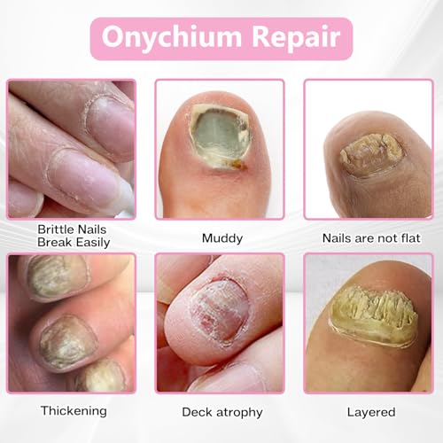 Nail Patches - Toenail Care for Toenail Fingernails - 8-Hour Nightime N ail Renewal - 60