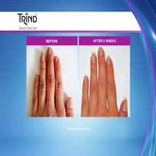 Trind Keratin Restorer, Nail Strengthener for Damaged Nails 9ml