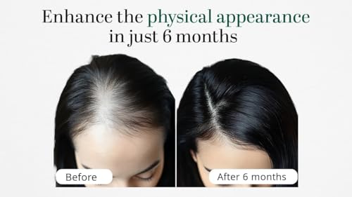 Advanced Hair Growth Support Supplement (180 Tablets, Supplement)