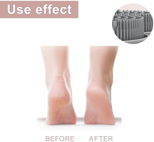 Shower Foot Scrubber Mat,Shower Foot and Back Scrubber with Suction Cups,Back Scrubber for Washer with Storage Hooks,Massager Cleaner Wash Brush(Gray)