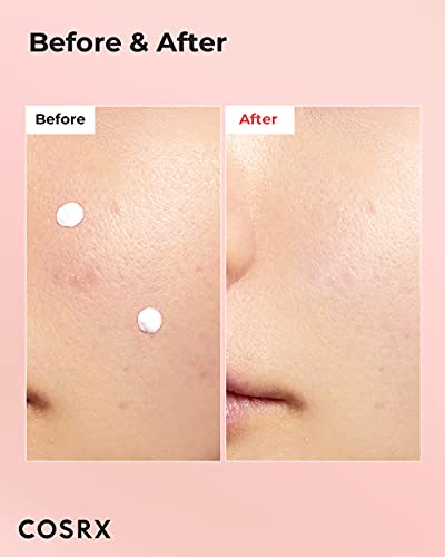 COSRX Acne Blemish Spot Drying Lotion 1.01 fl. oz / 30ml Dry and Reduce Blemish Spot, Pimple, Whitehead, Spot Treatment, Korean Skin Care