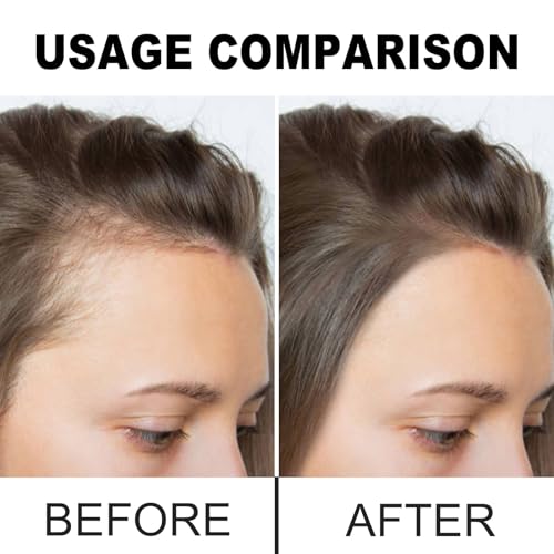 Batana Oil for Hair Growth, Divine Vitals 100% Organic Batana Hair Growth Oil, 100% Raw from Honduras, Prevent Hair Loss, Adds Thickness, Texture, Shine (1PCS)