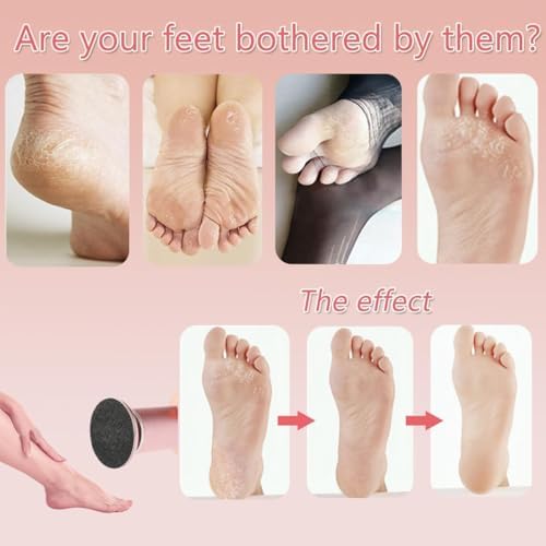 Dermave Electric Foot Callus Remover,Electric Callus Remover for Feet,with 60pcs Sanding Disc,Electric Speed Adjustable Foot File for Dead Skin Cracked Skin Calluses for Men and Women, Pink