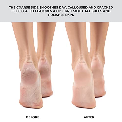 ForPro Pro Fusion Stainless Steel Pedi File - Coarse, Double-Sided Professional Quality - Blue Handle Pedicure File for Heels and Feet - 8.25” L