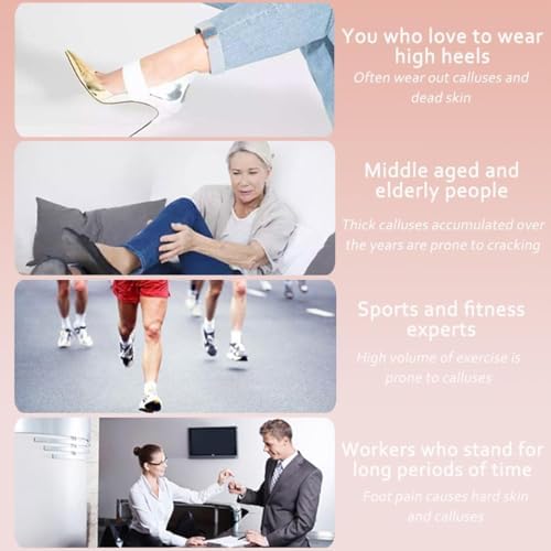 Dermave Electric Foot Callus Remover,Electric Callus Remover for Feet,with 60pcs Sanding Disc,Electric Speed Adjustable Foot File for Dead Skin Cracked Skin Calluses for Men and Women, Pink