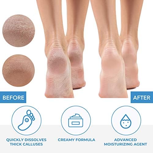 ForPro Professional Collection Premium Callus No More! Callus Remover, Fast-Acting Callus Removing Formula, 32 oz.