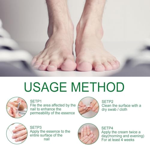 3PCS Ginger Nail Treatment, Ginger Cuticle Care Oil for Nails, Multi-Purpose Nail Repair Nutrient Oil (02)