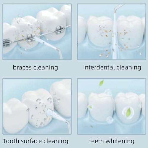 Replacement Hose and Handle Parts for Waterpik Replacement Heads,Compatible with Waterpik water flossers/WP-100 WP-300 WP-660 WP-662 WP-670 WP-672 WP-900