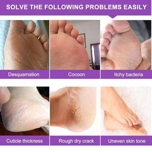 Foot Peeling Mask - 5 Pack, Exfoliating Mask Make Feet Baby Soft, Foot Mask for Dry Cracked Skin, Peeling Away Dead Skin, Calluses - Lavender
