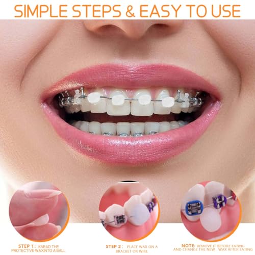 OBTANIM 30 Pack Colorful Braces Wax Dental Care Orthodontic Wax for Braces Wearer (10 Color)