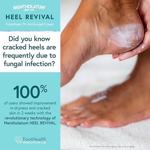 Mentholatum Heel Revival, Persistent Cracked Heel Repair Treatment, 1% Tolnaftate Antifungal Cream, Antifungal Foot Treatment, Eliminates & Prevents Fungus, 1 OZ