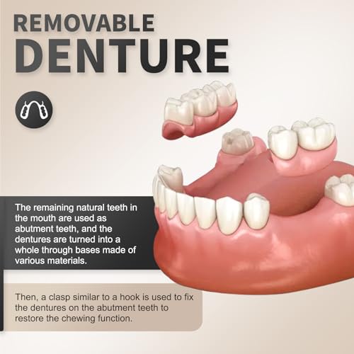 Custom Partial Dentures Removable Dentures, Portable Dental Prosthetics for Teeth (1 Tooth)