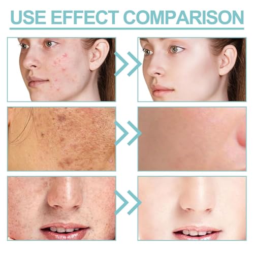 Milky Gluta 𝐖𝐡𝐢𝐭𝐞 Soap 20x, 70g Glutamilk 𝐖𝐡𝐢𝐭𝐞𝐧𝐢𝐧𝐠 Soap, Milkygluta 𝐖𝐡𝐢𝐭𝐞 Bar Soaps, Premium 𝐁𝐫𝐢𝐠𝐡𝐭𝐞𝐧𝐢𝐧𝐠 Soaps for Face & Body, Deep Cleanse, Exfoliate (1PCS)