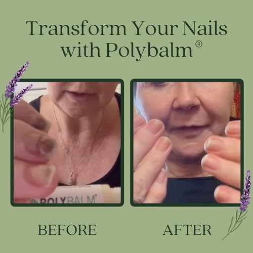 Nail Care – 100% NATURAL, Helps to Prevent, Protect & Strengthen Chemo Nails & Damaged Nails. Formulated by Dermatology, Cancer & Botanical Experts.