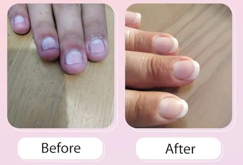 Mavala Nail Care Nailactan Nutritive, Nail Cream In Jar, Supports Damaged Nails, Nourishing, Moisturizing Nail Care Cuticle Cream, Promotes Nail Growth, 0.5 Ounce Jar