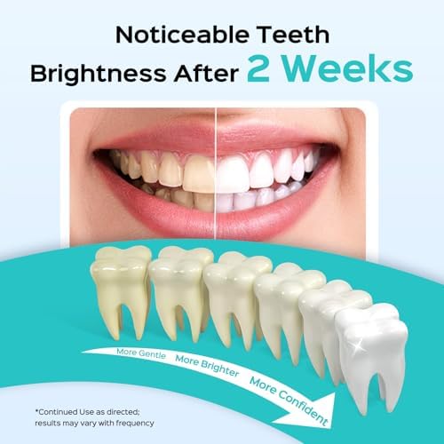 COSLUS Water Flosser Pick with 30pcs Whitening Mint Flavor Refill Combo for Teeth, Braces, Gums Care - Easy to Use, Portable for Coffee Lovers & Travel, Rechargeable, BPA-Free, Black, W40(F5020E)