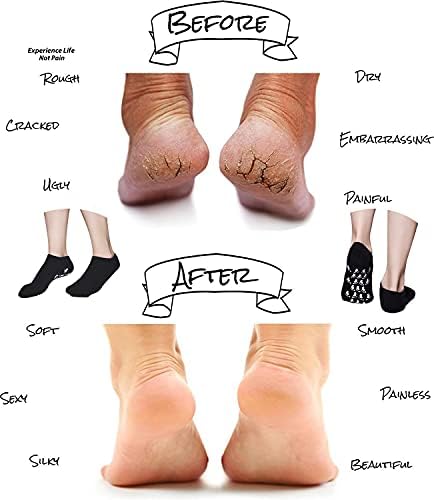 Gel Spa Moisturizing Gel Socks for Repairing and Softening Dry Cracked Feet Skins (Men Size(Black))