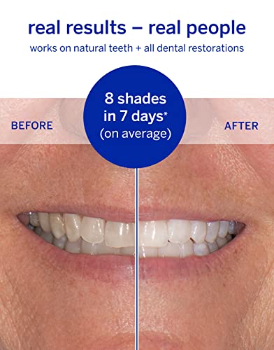 Dissolving Superstrips by Supersmile - Professional Teeth Whitening Strips - Enamel Safe Teeth Whitener for Sensitive Teeth…