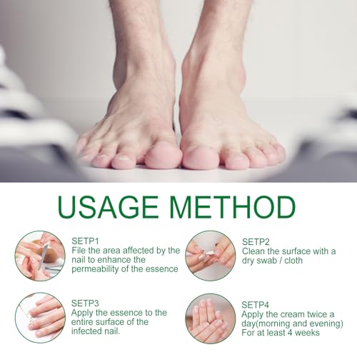 Ginger Nail Treatment Nail Support Nail Care, 7Days Nail Treatment Serum, Multi-Purpose Nail Repair