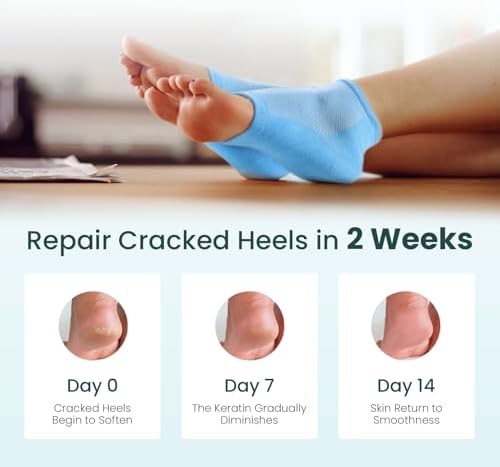 Moisturizing Heel Socks for Cracked Heel Treatment - Promifun 2 Pairs Moisturizer Socks for Dry Cracked Feet - Cracked Heel Repair - Heel Socks for Women & Men (Blue & Pink)