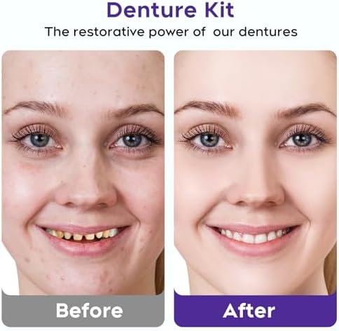 Denture Do it Yourself Full Set of Top and Bottom Fake Teeth, for Improve Smile，DIY Denture Kit- Natural Looking Emergency Replacement Solution, Customized Dentures(Universal Size)-0624-1