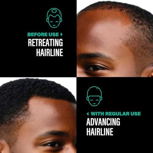 Batana Oil for Hair Growth, Divine Vitals 100% Organic Batana Hair Growth Oil, 100% Raw from Honduras, Prevent Hair Loss, Adds Thickness, Texture, Shine (1PCS)