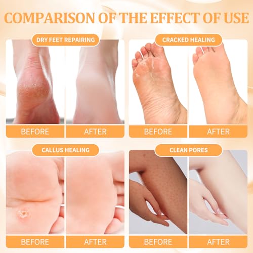 Pedicure Kit Foot Soak Set: Bubble Salt, Sugar Scrub, Massage Mask, Massage Lotion in a Box, 4 Step Foot Spa Kit for Dry Feet,Tired Feet（3 Set Tropical Fruit)