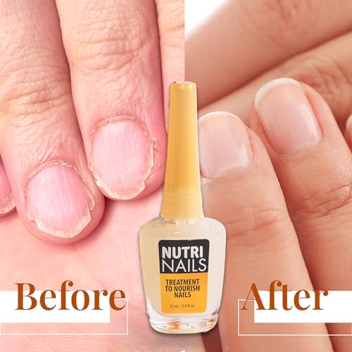 Nutri Nails: Nail Strengthener with Proteins, Minerals, Hyaluronic Acid & Vitamins - Nail Hardener, Growth & Nail Biting Treatment for Damaged Nails and Adults.