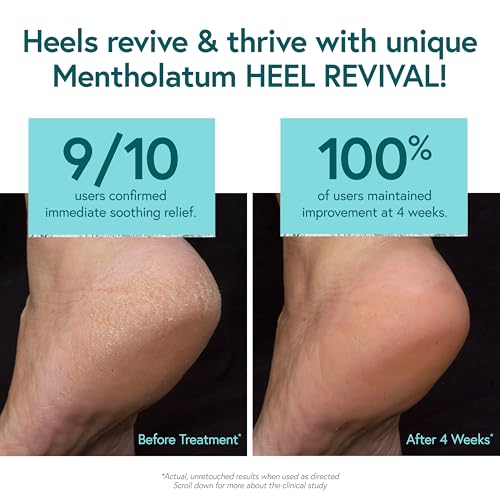 Mentholatum Heel Revival, Persistent Cracked Heel Repair Treatment, 1% Tolnaftate Antifungal Cream, Antifungal Foot Treatment, Eliminates & Prevents Fungus, 1 OZ