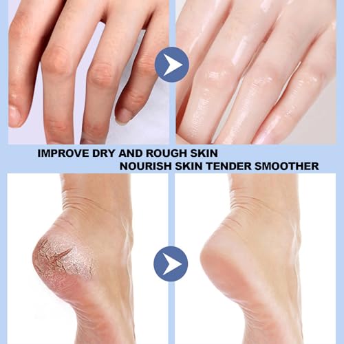 Crack Feet Prevention Stick, Foot Care Cream Cracked Feet, Moisturizing Foot Balm Stick, Softening and Nourishing Cream for For Dry Heels