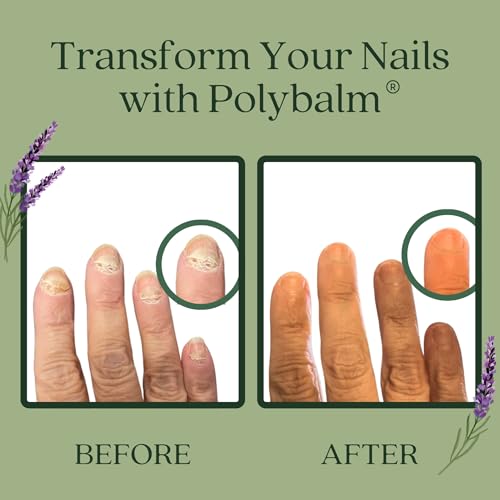Nail Care – 100% NATURAL, Helps to Prevent, Protect & Strengthen Chemo Nails & Damaged Nails. Formulated by Dermatology, Cancer & Botanical Experts.