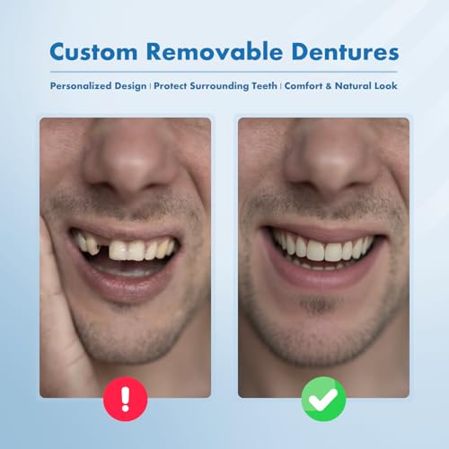 Custom Removable Dentures – Personalized Partial Denture Set for Tooth Replacement | 1–Multi-Tooth Coverage with Storage Case | Comfortable Wear for teeth (1 Tooth)