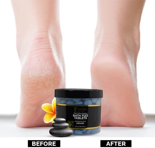 Bath Fizz, Mint & Eucalyptus - Relaxing Aromatherapy - 42 Ounces