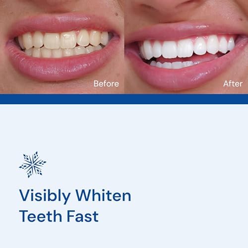 SNOW Diamond Dissolving Teeth Whitening Strips - Gentle & Enamel Safe White Strips for Teeth Whitening, at-Home Dental Hygiene & Tooth Care with Hydroxyapatite - 14 Ct