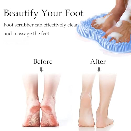 Shower Foot and Back Scrubber Mat,Wall Mounted Shower Foot Scrubber with Suction Cups,Exfoliating Silicone Massage Foot Cleaner for Shower(2pcs)