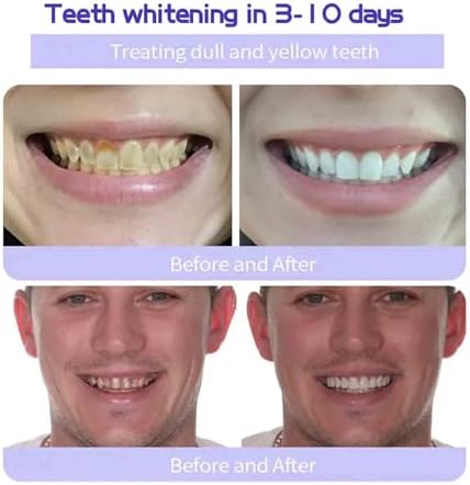 Odalit Teethrestoration Mineral Powder, Teeth Whitening & Strengthening, Breath Fresh Protect Teeth and Gums and Solve Oral Problems (1)