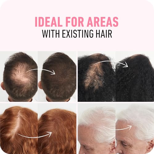 BOLDIFY Hair Fibers (2 x 56g) - Fill In Thinning and Fine Hair for an Instantly Fuller, Thicker Look - 14 Shades for Women & Men - Black