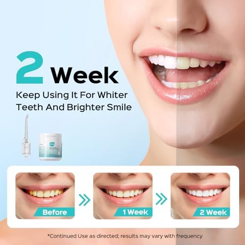 COSLUS Whitening Water Flosser Replacement Tips with 60 Pcs Mint Refills: Compatible with C20 (F5020E) & E40 (WFP14) Portable Water Flossers – Improve Stains Gently& Fresh Breath for Daily Oral Care