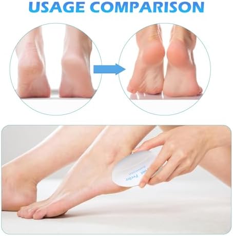 Foot Dead Skin Remover Tool, Egg Callus Removal for Feet, Foot Heel Peeler Scraper for Remove Cracked Heels