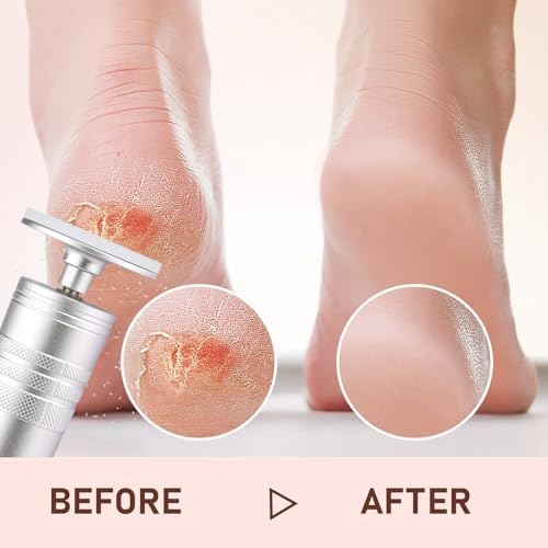 Kredioo Electric Foot Callus Remover Nano Glass Foot File German Technology Grinding Sanding Pedicure Tool for Feet Sensitive Skin Safe Adjust Speed R/F Direction Remove Thick Toe Nails