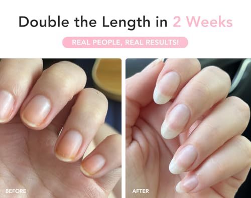 Liaison UltraGrow Nail Serum for Growth and Strength with Keratin Complex, Olive Oil & Vitamin E | Dermatologist-Tested to Support Weak, Brittle, Splitting Nails