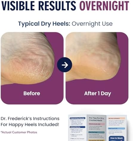 Dr. Frederick's Original Moisturizing Fuzzy Heel Socks - 2 Pairs - Cozy Gel-Lined Sleep Socks for Women & Men - Soothes Dry, Cracked Feet - Heel Repair - Relaxing Rose