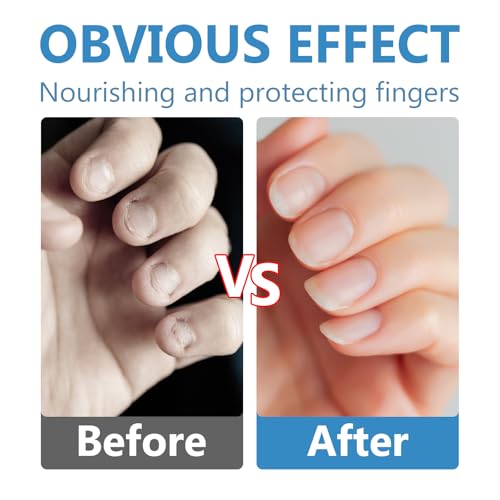 Nail Biting Prevention-Nail Biting Treatment for Kids-Anti-Nail Biting Thumb Cream for Kids-100% Natural Bitter Formula-No Additives-Protects Nails Healthy Nail Growth-Safe for Children, 60ml