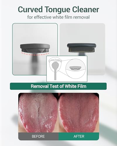 DEARCUS Korean Tongue Scraper with 3 Replaceable Heads - 100% BPA Free TPE Tongue Cleaner - Reduce Bad Breath & Without Hurt - Hygienic Scraper - Modern & Simple Design (White)