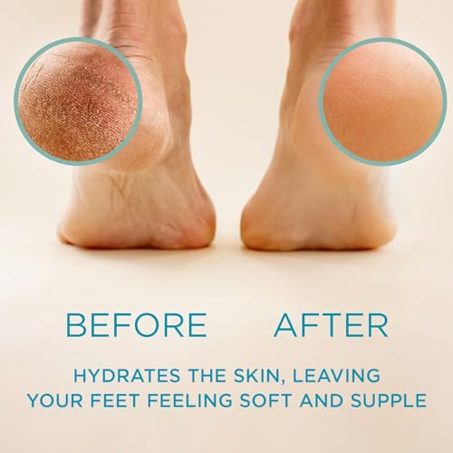 Lee Beauty Professional Callus Remover for Feet - Extra Strength Gel & Rasp Foot File Kit - Original Formula for Dead Skin Remover for Cracked Heels & Dry Skin-Pedicure Supplies for Smooth Foot - 8 Oz
